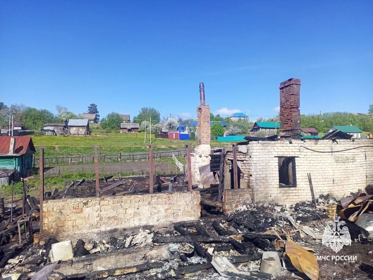 Житель Красноусольского при пожаре спас родителей и бабушку, а сам получил ожоги