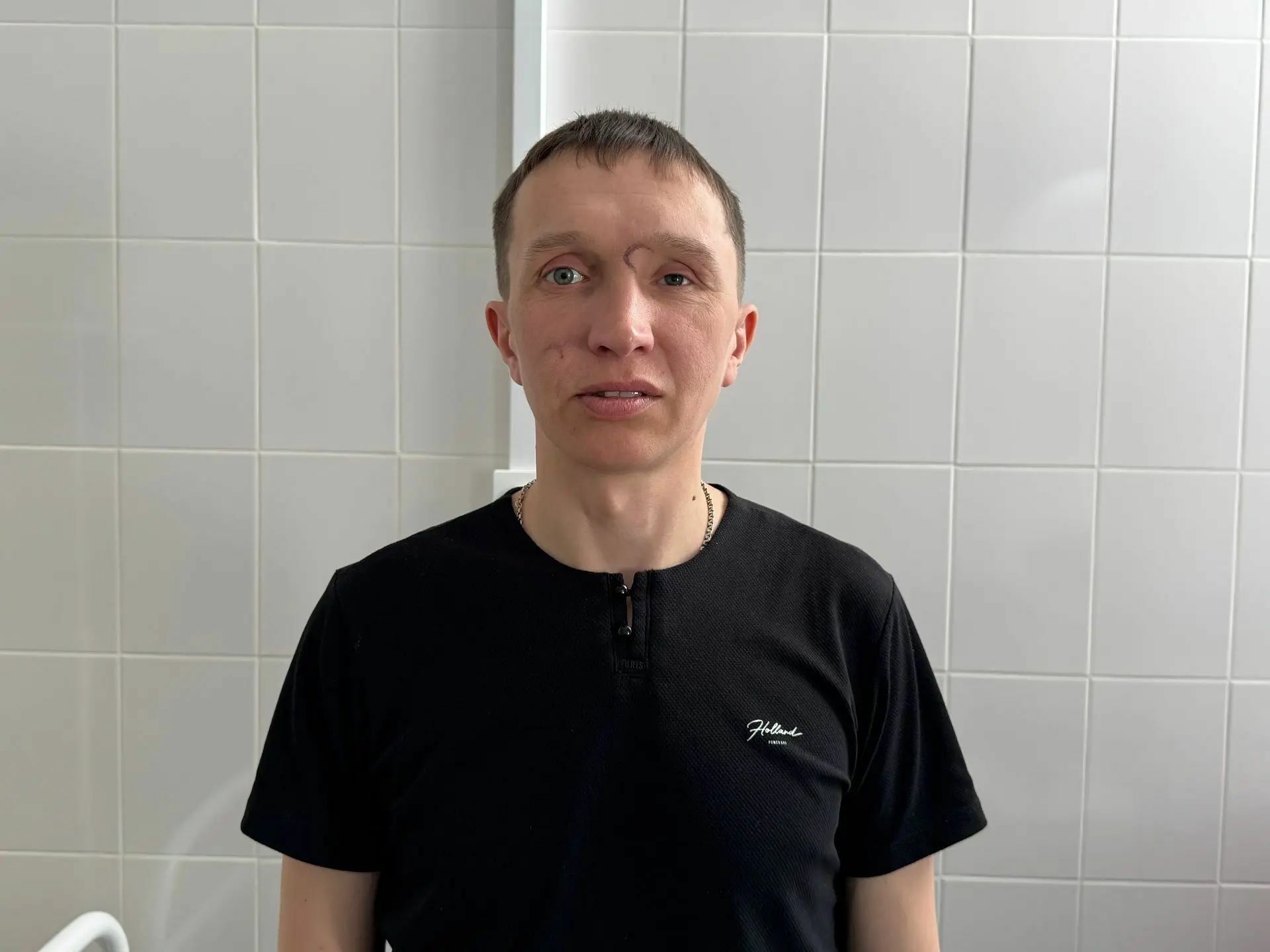 В Башкортостане ветерану СВО провели цикл пластических операций